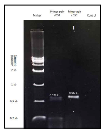 PCR primer test with A549 cancer cell cDNA shows FAM72 primer specificity