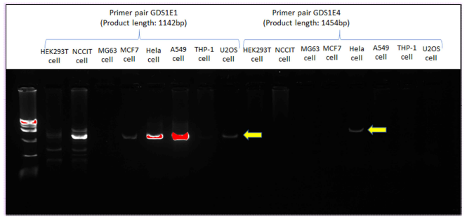 PCR primer test with various cancer cell genomic DNA shows FAM72 primer specificity