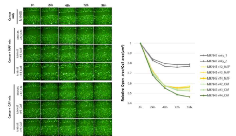 Wound scratch assay with Non-CAF and CAF + MKN45