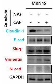 Western blot with EMT markers in Non-CAF and CAF + MKN45