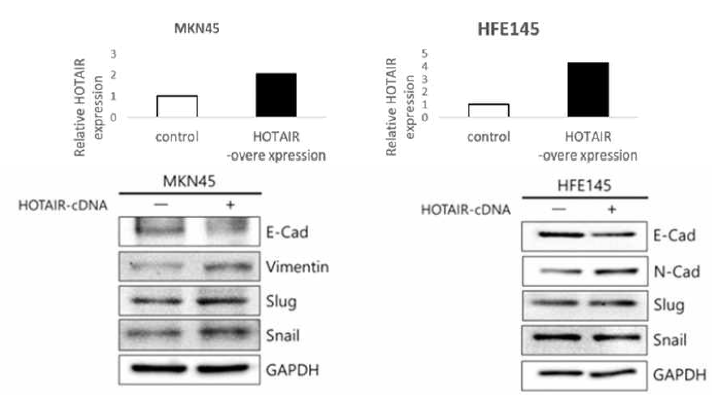 Over-expression of HOTAIR in MKN45 and HFE145