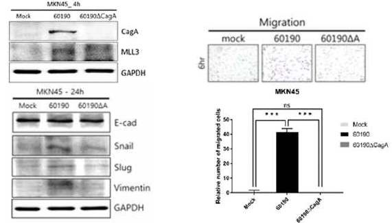 unpublished data) MKN45 infected with H.pylori