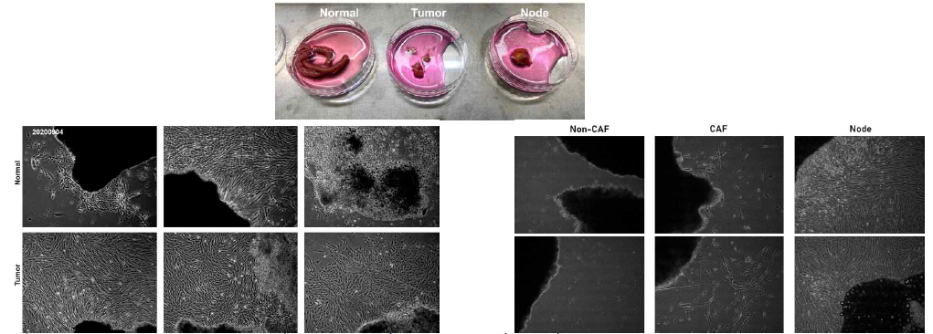위암 환자의 조직에서 분리한 Non-CAF and CAF 배양