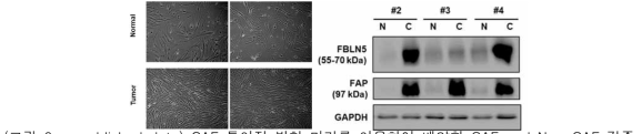 CAF 특이적 발현 마커를 이용하여 배양한 CAF and Non-CAF 검증