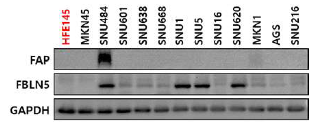 FBLN5 screening with Normal epithelial cell and Gastric cancer cell lines