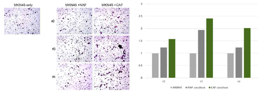 Migration assay with Non-CAF and CAF + MKN45