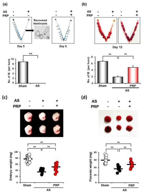 PRP 치료 후 AS mouse model 자궁내 환경 개선되어, (a)치료전 AS에서는 착상이 안되던 배아들이 PRP치료후 임신5일차에 착상된 소견을 보였으며, (b) 임신12일차에 착상된 배아 개수가 유의하게 늘어났고, (c-d) PRP치료군에 착상된 배아 및 태반의 무게가 AS군에 비해 더 늘어난 것을 확인할 수 있었다