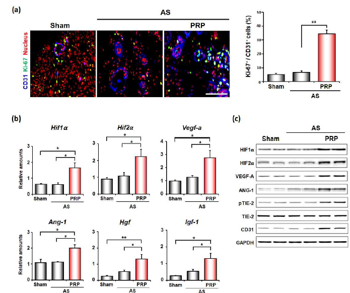 PRP치료시 AS 자궁의 손상된 angiogenesis를 개선시키는 것을 알 수 있다. (a) KI-67/CD31 positive cell percentage증가, 그 외 (b) RT-PCR, (c) western blotting상 angiogenesis marker들이 PRP치료 후 모두 증가한 소견을 보인다