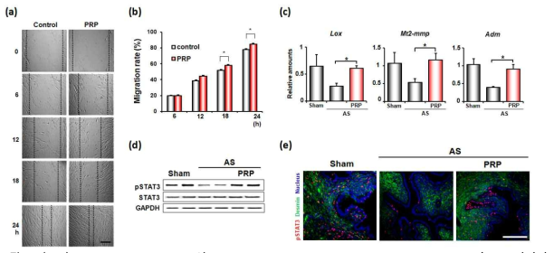 (a-b) Wound-healing assay상 human endometrial stromal cell migration rate가 PRP처리시 유의하게 증가, (c) RT-PCR상 endometrial remodeling관련된 marker들의 증가, (d-e) tissue remodeling과 regeneration에 중요한 transcription factor인 STAT3 역시 증가함을 볼 수 있다