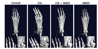 CIA 모델에서 Micro-CT 비교