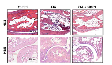 CIA 모델에서 H&E staining 비교