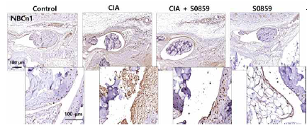 CIA 모델에서 IHC staining 비교