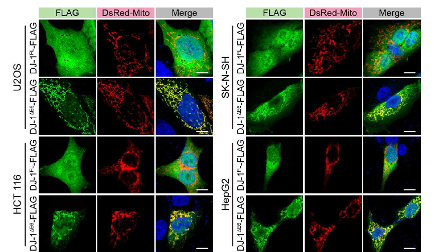 DJ-1ΔE6 isoform의 세포 내 위치