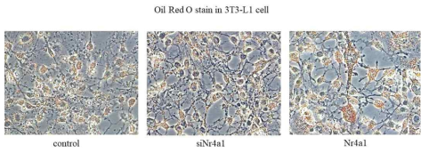 Nr4a1을 발현억제 및 과발현시킨 3T3-L1 세포에서 adipocyte induction 9d 후 이미지 촬영