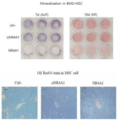 NR4A1을 발현억제 및 과발현시킨 BMD-MSC 세포에서 7d Alkaline phosphatase 와 10d nodule formation 및 adipocyte induction 후 실험을 진행