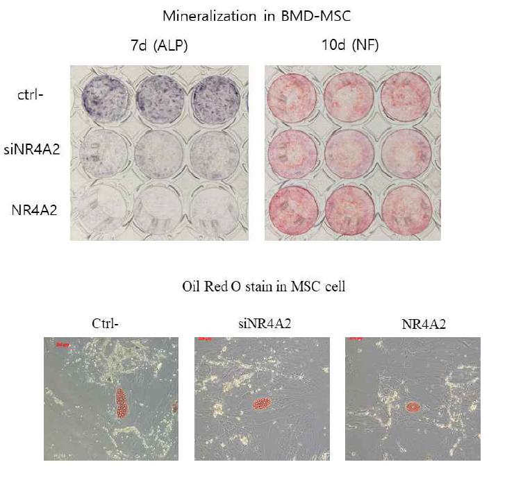 NR4A2를 발현억제 및 과발현시킨 BMD-MSC 세포에서 7d Alkaline phosphatase 와 10d nodule formation 및 adipocyte induction 후 실험을 진행