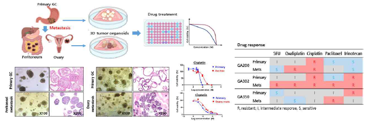 복막전이/난소전이암 오가노이드 모델의 약물 반응성