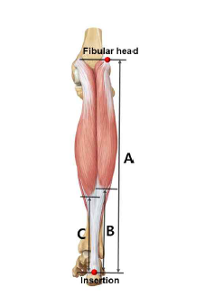 가자미근과 발꿈치힘줄의 위치와 길이 측정 Measurements of the calcaneal tedon and gastrocnemius muscle