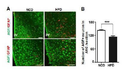 고지방식이 유도 비만마우스에서 시상하부내의 성상세포 활성화가 증가 (A), AGF발현 신경세포 감소 (B)