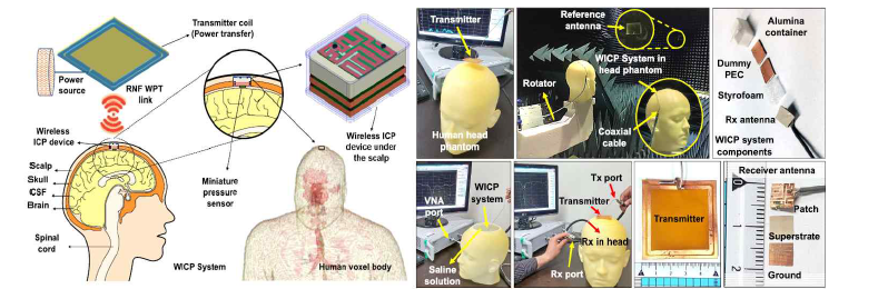 무선 두개내압(ICP) 모니터링 시스템 및 Tx를 통한 무선전력전송실험 setup