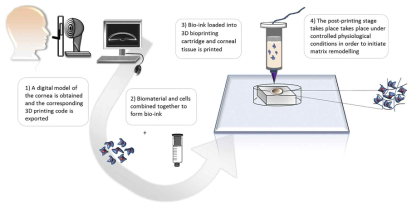 3D 바이오 프린팅을 이용한 각막 기질 유사 대체물 제작