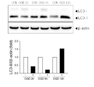 시간별 autophagy 변화