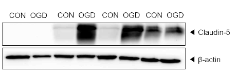 OGD-claudin-5 변화