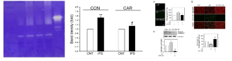 Zymogram을 이용한 MMP-2/9 활성 조절(좌); 만성 염증 apoptosis 조절영향을 나타내는 신규활성물질 개발(우)