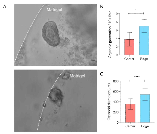 마트리젤 위치에 따른 오가노이드 생성 차이