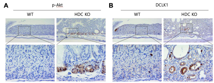 WT과 HDC KO의 위조직에서 p-AKT와 DCLK1의 발현 확인