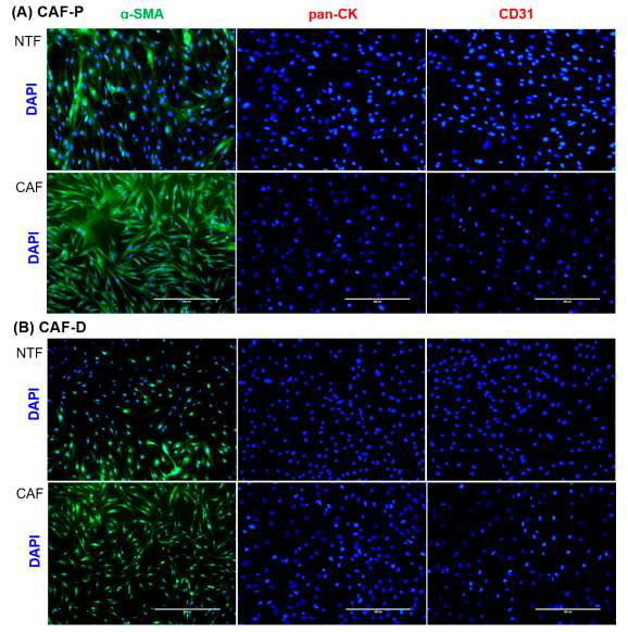 Immunocytochemical analysis of primary fibroblasts cultured from HNSCC patients’ tissues. (A,B) The same number of primary fibroblast cells after three passages were seeded in six-well plates containing cover slides and immunostained with antibodies specific for fibroblasts (α-SMA), epithelial cells (pan-CK), and endothelial cells (CD31). (scale bar, 200 μM)