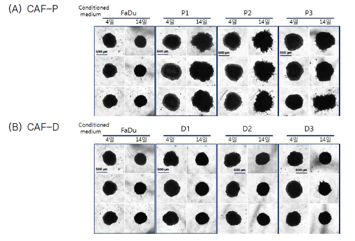 Effect of CAF-P and CAF-D on Matrigel invasion of FaDu spheroids. Spheroid formation was performed in 96-well U-bottom Ultra-Low Attachment plate for two – three days, followed by medium change containing conditioned medium from CAF-P or CAF-D. The spheroid size was monitored for 14 days using a phase-contrast microscopy (5x magnification)