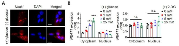 당 농에 반응하여 NEAT1이 핵에서 세포질로 이동. (A) 마우스 유방암 세포주의 RNA-FISH 결과. (B) MCF7 세포로 세포질과 핵의 분획 실험 후 당 농도에 따른 NEAT1의 발현 정도를 qPCR로 확인