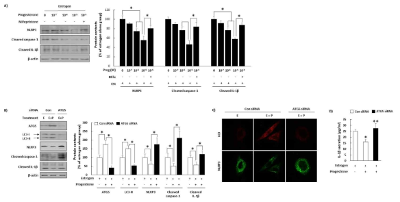 Progesteorne이 estrogen-매개 NLPR3 inflammasome 활성화에 미치는 영향