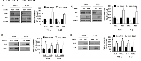 ER stress가 NF-kB signaling과 염증성 사이토카인 발현에 미치는 영향