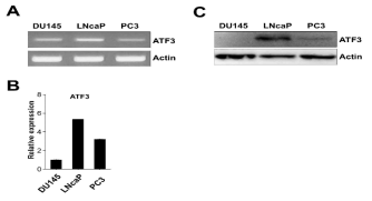 Expression profiles of ATF3 in prostate cancer cell lines