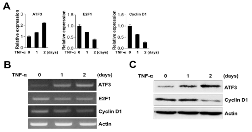 Tumor necrosis factor‐α (TNF‐α) induces ATF3 expression in prostate cancer cells. A,B, Total RNA and protein were extracted from prostate cancer cells, and their mRNA and protein levels were analyzed using RT‐PCR A and Western blotting B