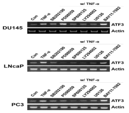 ATF3 modulates the TNF-α-mediated signaling via the JNK pathway in prostate cancer cells