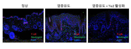 Tie2 활성화에 의한 염증 억제 효과 규명 피부 염증 유도 시 Tie2 활성화가 감소하고 면역 세포의 이동이 증가하여 염증이 만성화됨. 이는 Tie2 활성화를 유 도하는 약물 처리에 의해 억제 가 능 (unpublished)