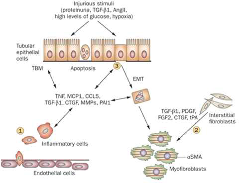 신손상에 의한 신섬유화 과정 (Liu et al. Nature Reviews Nephrology, 2011)