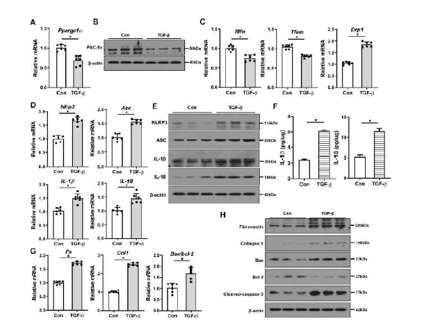 신섬유화 과정에서 PGC-1α, 미토콘드리아, NLRP3 inflammasome의 변화