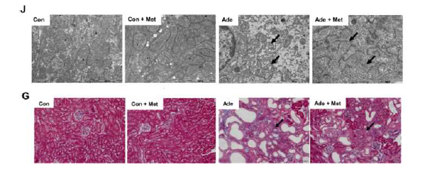 Metformin 투여에 따른 미토콘드리아 구조 회복과 신섬유화의 완화