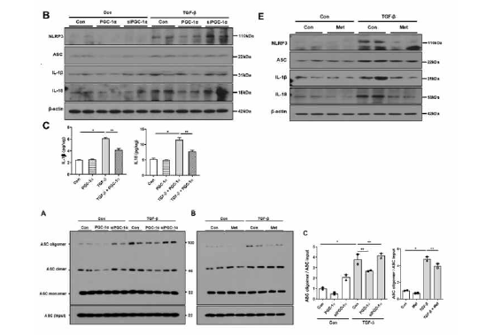 PGC-1α 발현에 따른 NLRP3 inflammasome의 조립화와 활성도