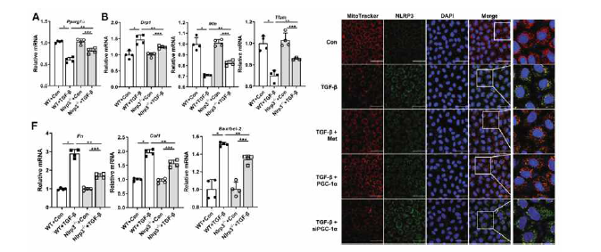 신섬유화 과정에서 미토콘드리아와 NLRP3 inflammasome의 상호 관계