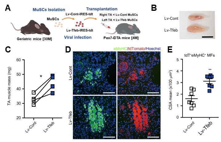 Tfeb 유전자 도입을 통한 노화 근육줄기세포 기능 회복. (A) 노령 개체의 근육줄기세포에 유전자 도입 후 이식 실험 모식도. (B-C) 근육재생 후 근육 무게. (D-E) 근육재생 후 근육 단면 면역 염색 및 근섬유 단면적 정량화