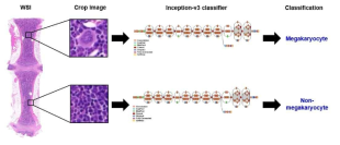 Overview of whole slide classification of histopathological patterns. We used a sliding window approach on the whole slide to generate small patches, classified each patch with Inception-v3 neural network, aggregate the patch predictions, and used a heuristic to determine predominant and minor patterns for the whole slide. Patch prediction were made independently of adjacent patches and relative location in the whole-slide image