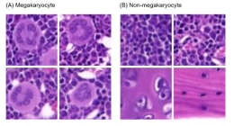 Representative cropped figures of megakaryocyte and non-megakaryocyte. (A) Megakaryocyte, (B) Non-megakaryocyte