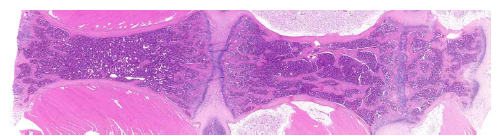 Representative WSI histopathological figure of bone marrow