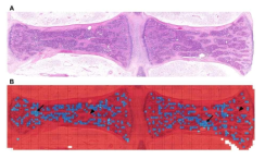 Visualization of megakaryocyte or non-megakaryocyte in bone marrow. (A) Original H (B) Visualized image. Megakaryocyte as blue color (arrow) and non-megakaryocyte as red color (arrow head)