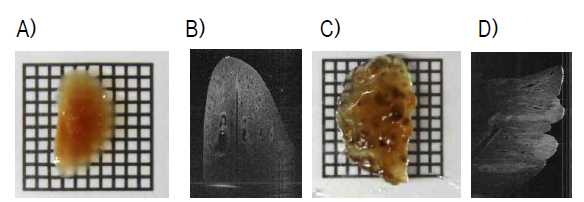 OCT를 이용한 폐전이종양의 영상 A) 정상 폐장의 macro view; B) 정상 폐장의 OCT 영상; C) 폐전이종양의 macro view; D) 폐전이종양의 OCT 영상